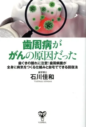 歯周病ががんの原因だった 歯ぐきの腫れに注意!歯周病菌が全身に病気をつくる仕組みと自宅でできる回復法